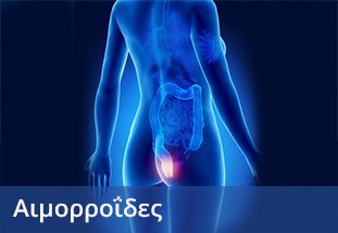 Αιμορροΐδες